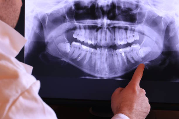 Best Emergency Tooth Extraction in Kent City, MI