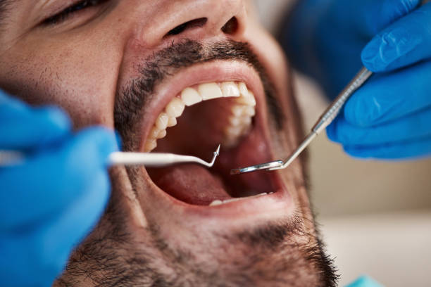 Best Same-Day Emergency Dentist in Kent City, MI